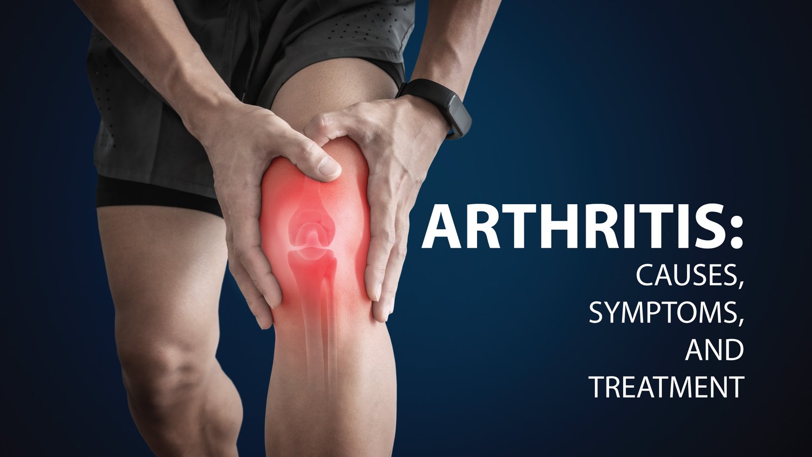 Osteoarthritis or knee wear - What is it, causes, symptoms and treatment 