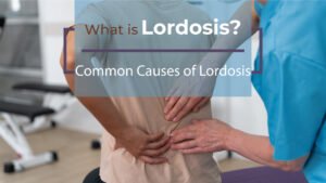 What is Lordosis? Causes, Symptoms, Treatments, Types of Lordosis