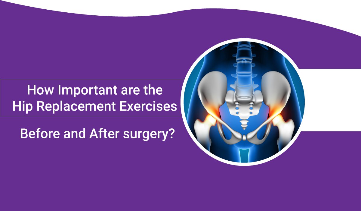 hip replacement exercises before and after surgery
